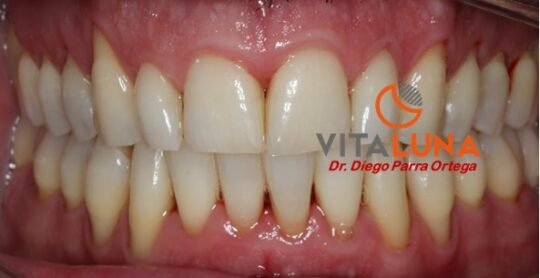 La Enfermedad Periodontal Y Su Impacto En Nuestra Salud General VITALUNA